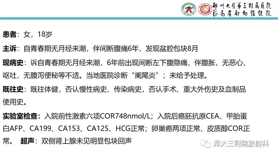 【病例】卵巢无性细胞瘤1例MR影像 【病例】卵巢无性细胞瘤1例MR影像