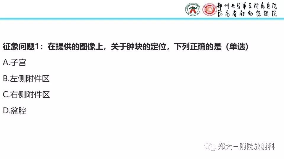 【病例】卵巢无性细胞瘤1例MR影像 【病例】卵巢无性细胞瘤1例MR影像