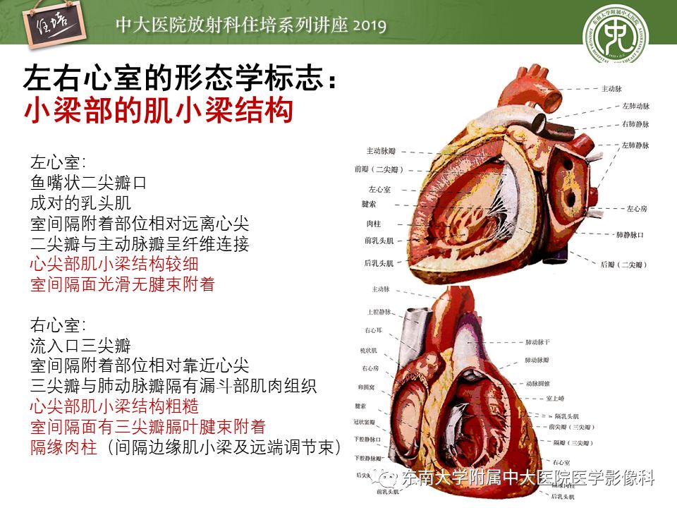 【PPT】复杂先心病分段分析法简介