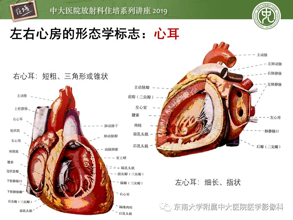 【PPT】复杂先心病分段分析法简介