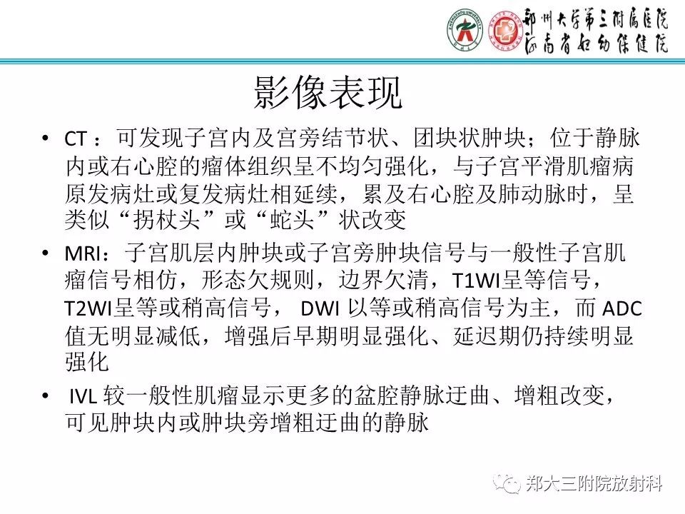 【病例】子宫静脉内平滑肌瘤病1例MR影像 【病例】子宫静脉内平滑肌瘤病1例MR影像