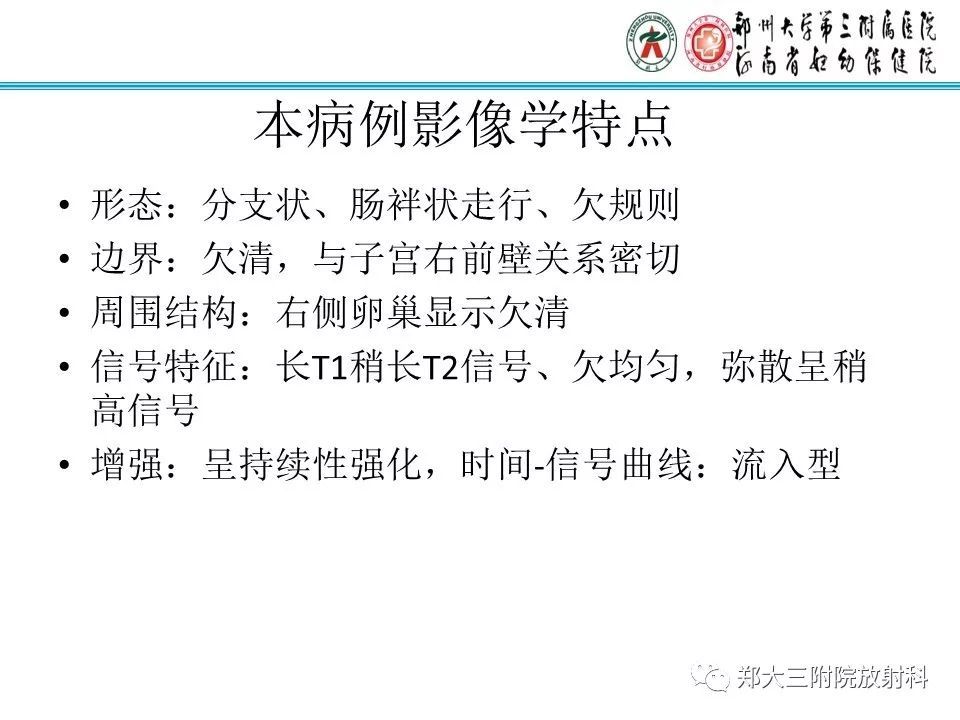 【病例】子宫静脉内平滑肌瘤病1例MR影像 【病例】子宫静脉内平滑肌瘤病1例MR影像