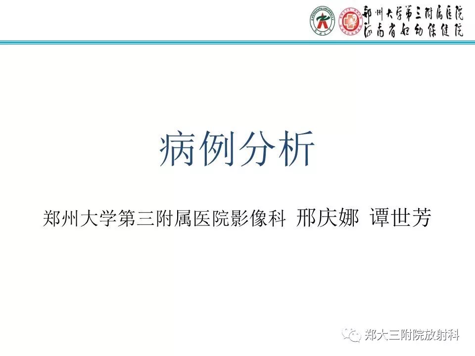 【病例】子宫静脉内平滑肌瘤病1例MR影像