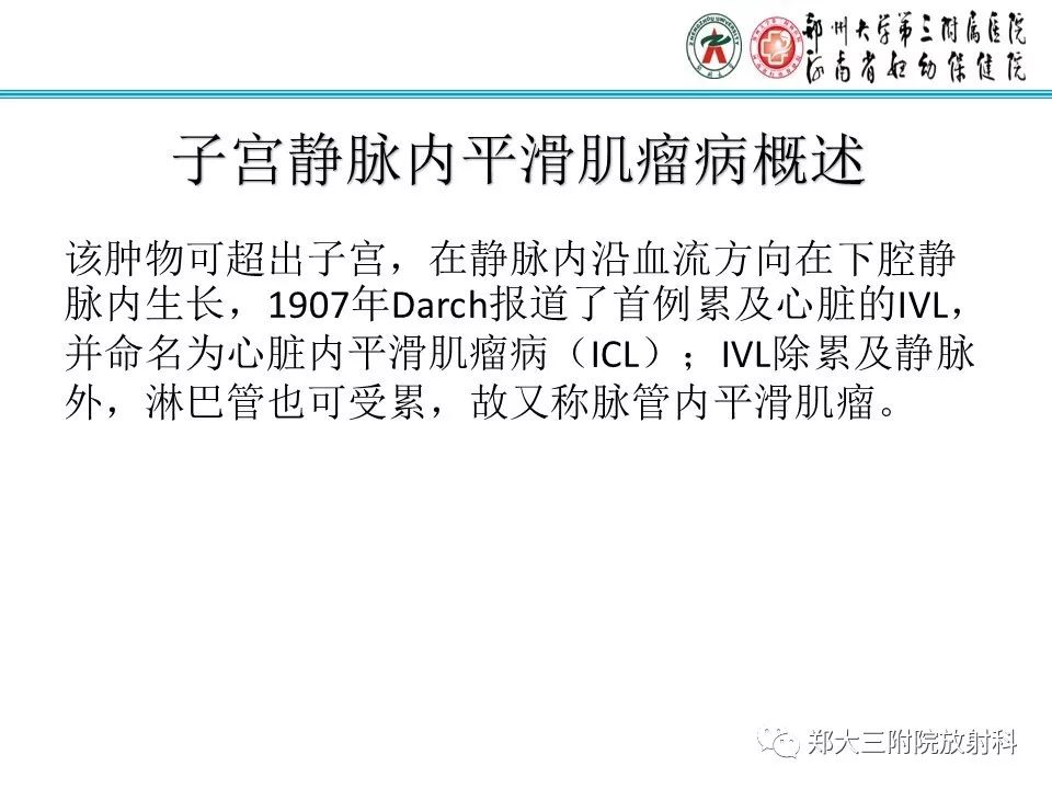 【病例】子宫静脉内平滑肌瘤病1例MR影像 【病例】子宫静脉内平滑肌瘤病1例MR影像