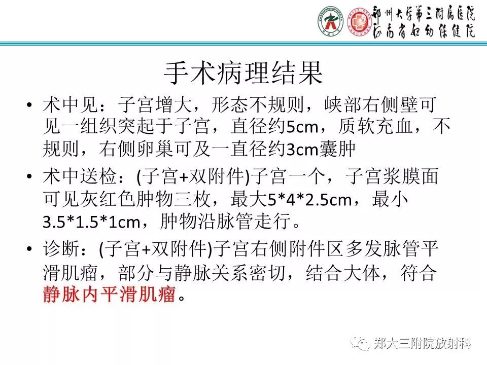 【病例】子宫静脉内平滑肌瘤病1例MR影像 【病例】子宫静脉内平滑肌瘤病1例MR影像