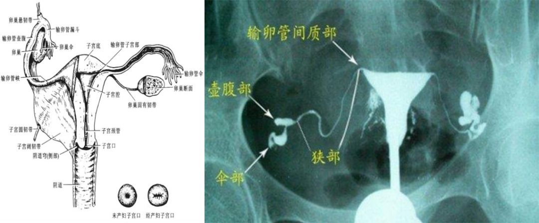 女性盆腔附件解剖及其常见肿瘤的影像表现