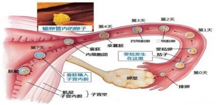 女性盆腔附件解剖及其常见肿瘤的影像表现