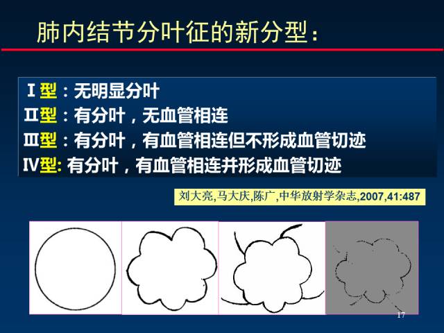 【PPT】肺癌CT征象的再探讨