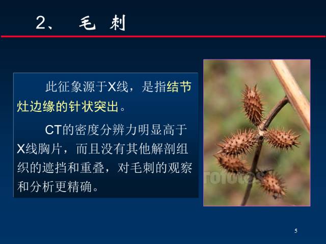 【PPT】肺癌CT征象的再探讨
