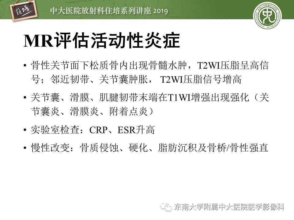 【PPT】强直性脊柱炎影像学评估