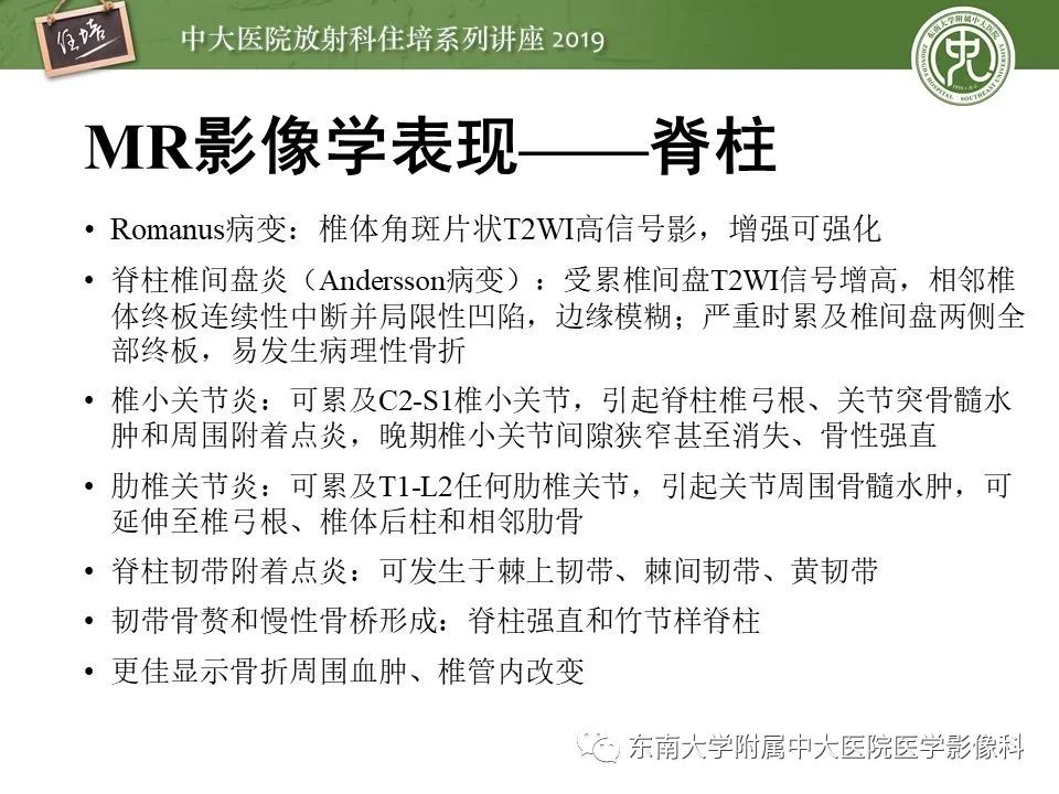 【PPT】强直性脊柱炎影像学评估