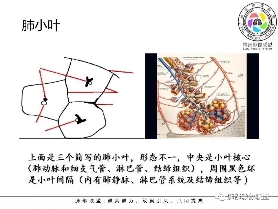 【PPT】如何快速掌握新冠肺炎（NCP）的影像识别？