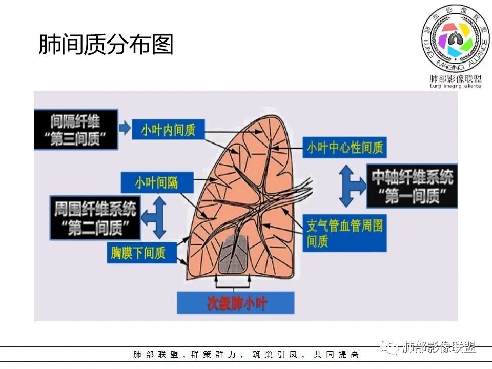 【PPT】如何快速掌握新冠肺炎（NCP）的影像识别？