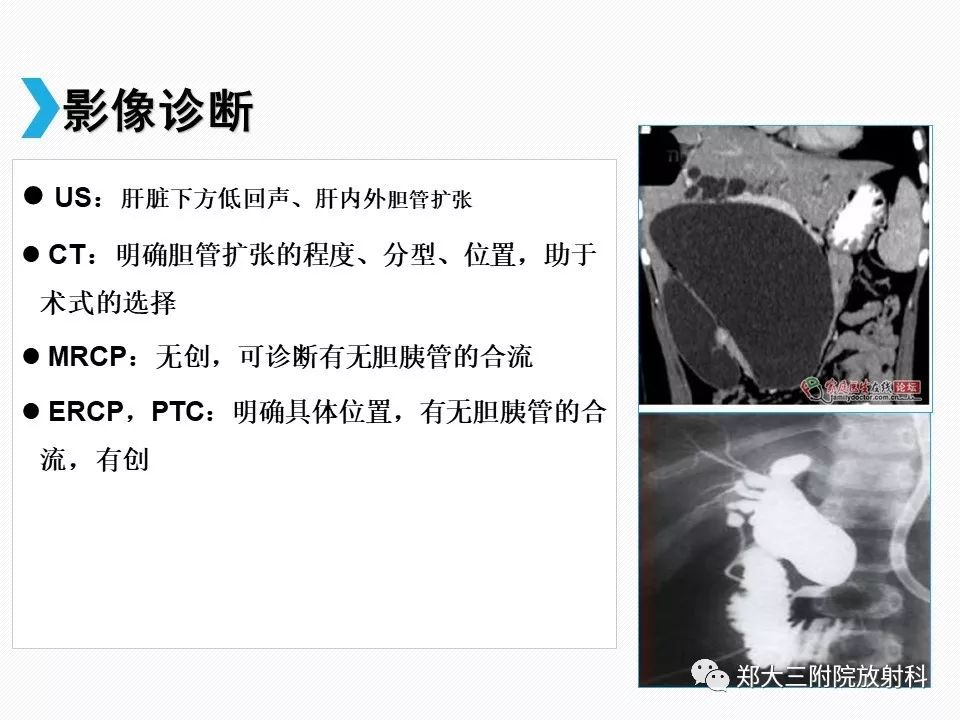 【PPT】小儿先天性胆总管囊肿CT诊断 【PPT】小儿先天性胆总管囊肿CT诊断