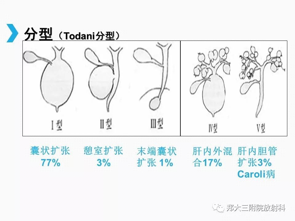 【PPT】小儿先天性胆总管囊肿CT诊断 【PPT】小儿先天性胆总管囊肿CT诊断