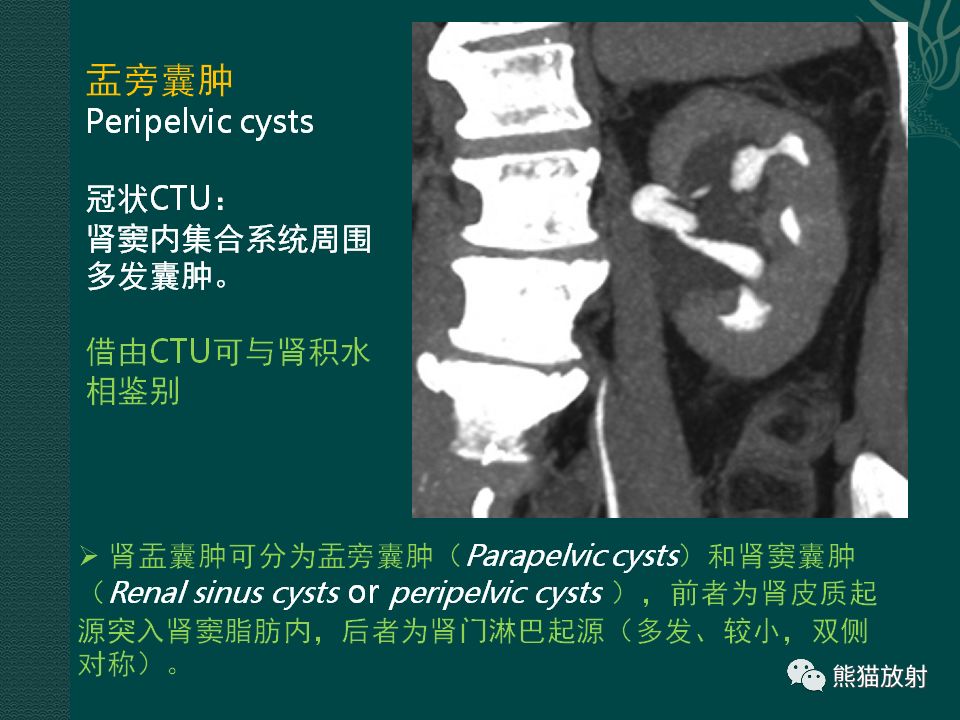 【PPT】肾脏囊性病变的CT及MRI表现 【PPT】肾脏囊性病变的CT及MRI表现