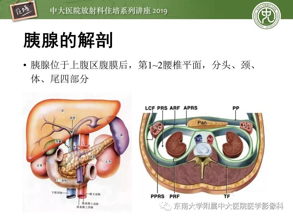 【PPT】胰腺炎的影像评估
