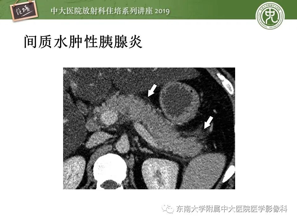 【PPT】胰腺炎的影像评估