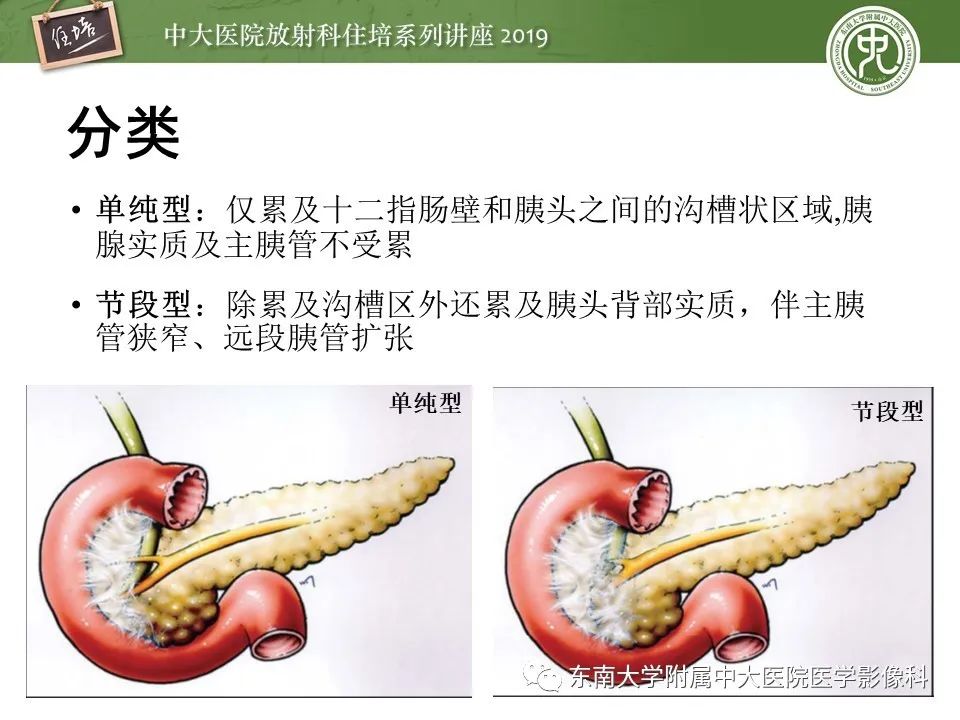 【PPT】胰腺炎的影像评估