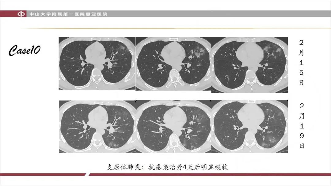 【PPT】NCP学习小结与病例分享