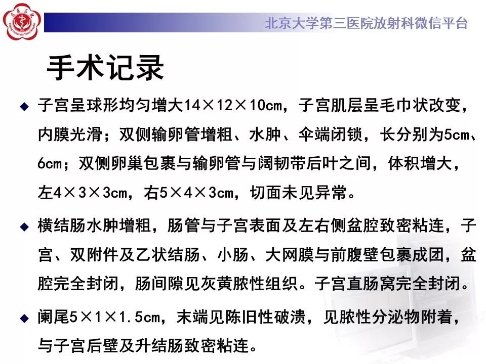 【病例】盆腔炎1例MR影像