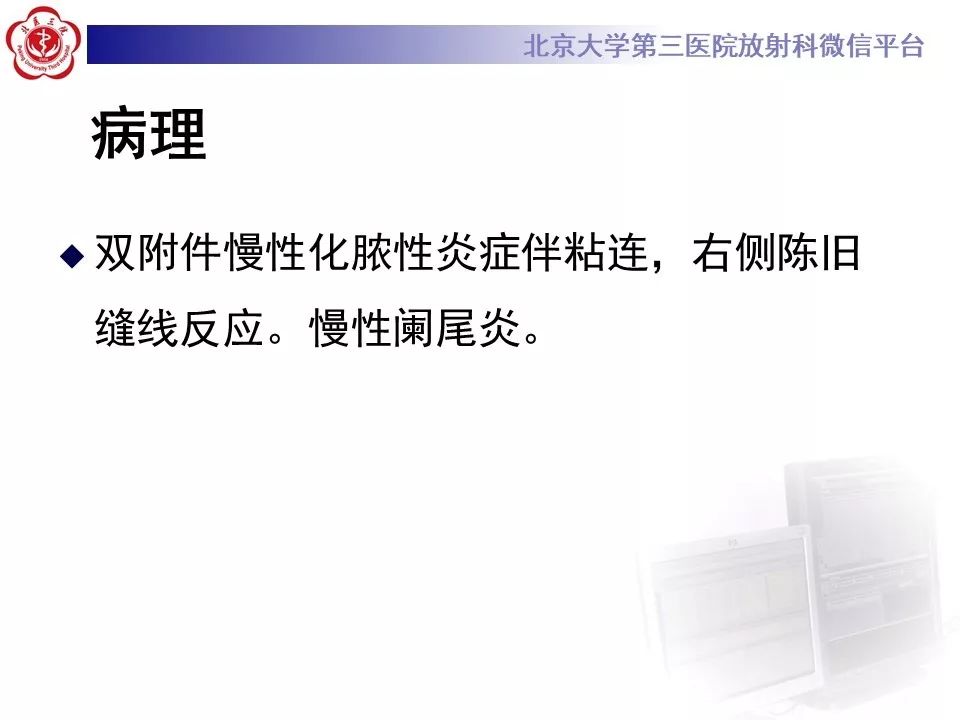 【病例】盆腔炎1例MR影像