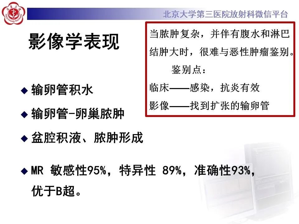 【病例】盆腔炎1例MR影像