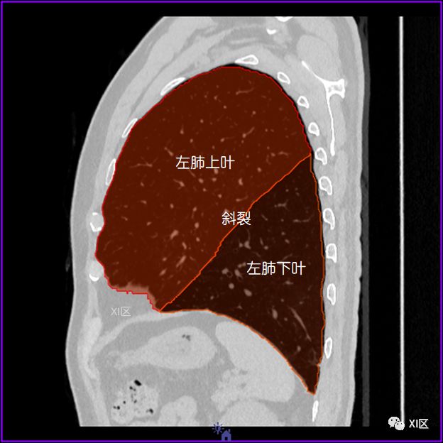 肺部影像解剖