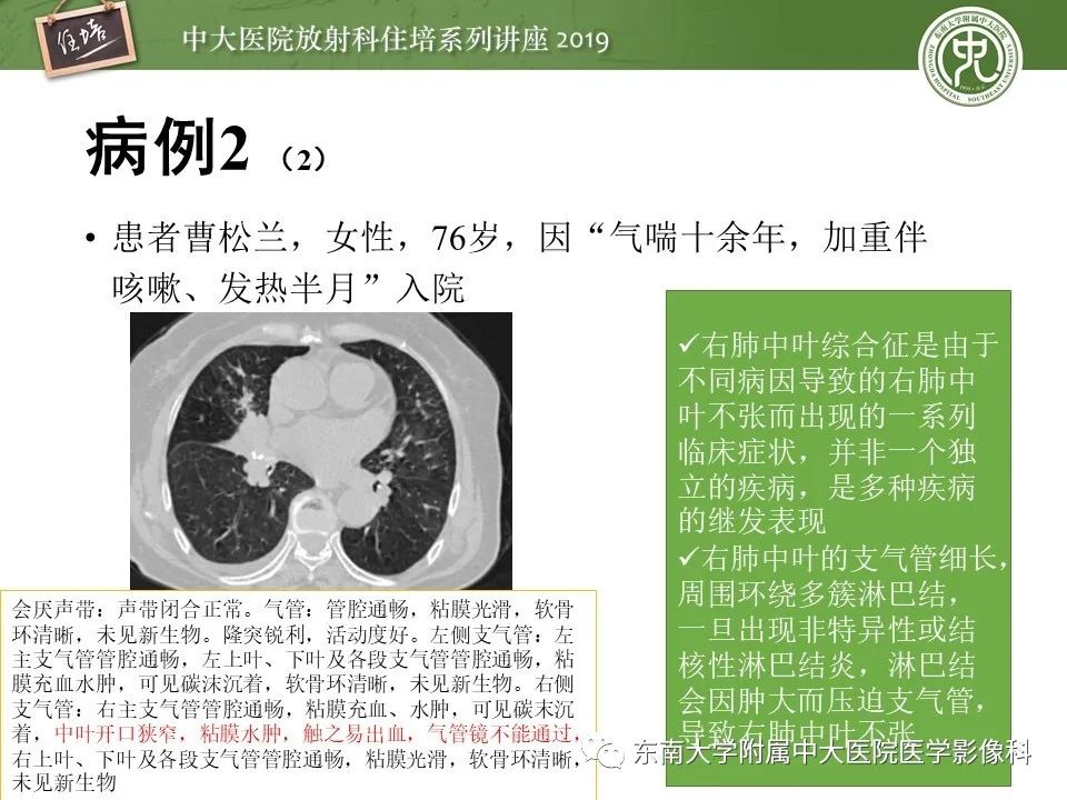 【PPT】呼吸系统急症影像解读