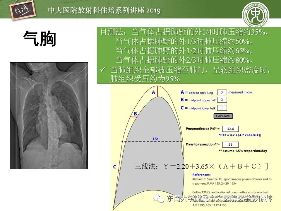 【PPT】呼吸系统急症影像解读