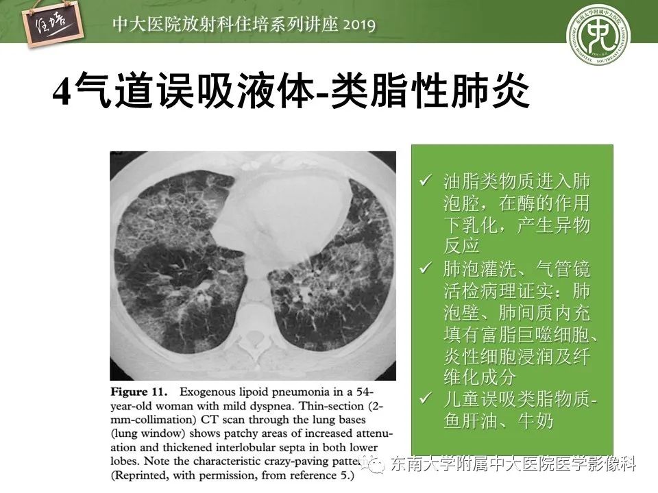 【PPT】呼吸系统急症影像解读