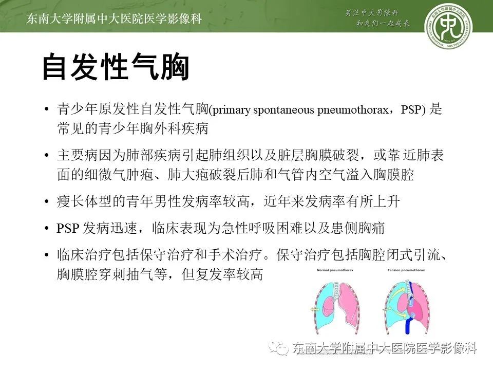 【PPT】呼吸系统急症影像解读