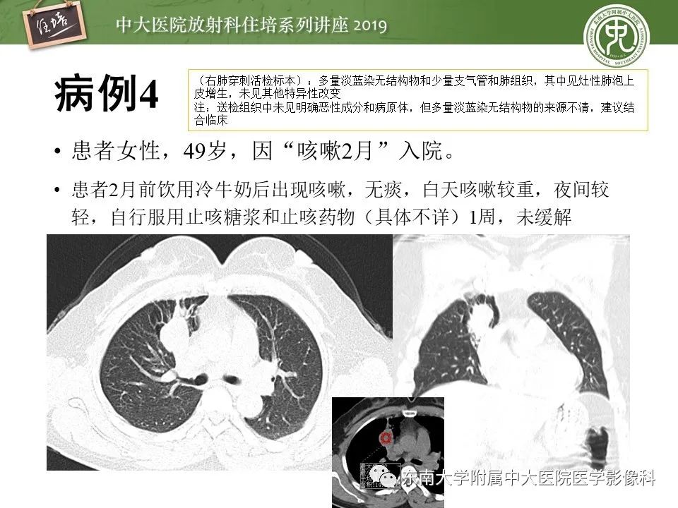 【PPT】呼吸系统急症影像解读