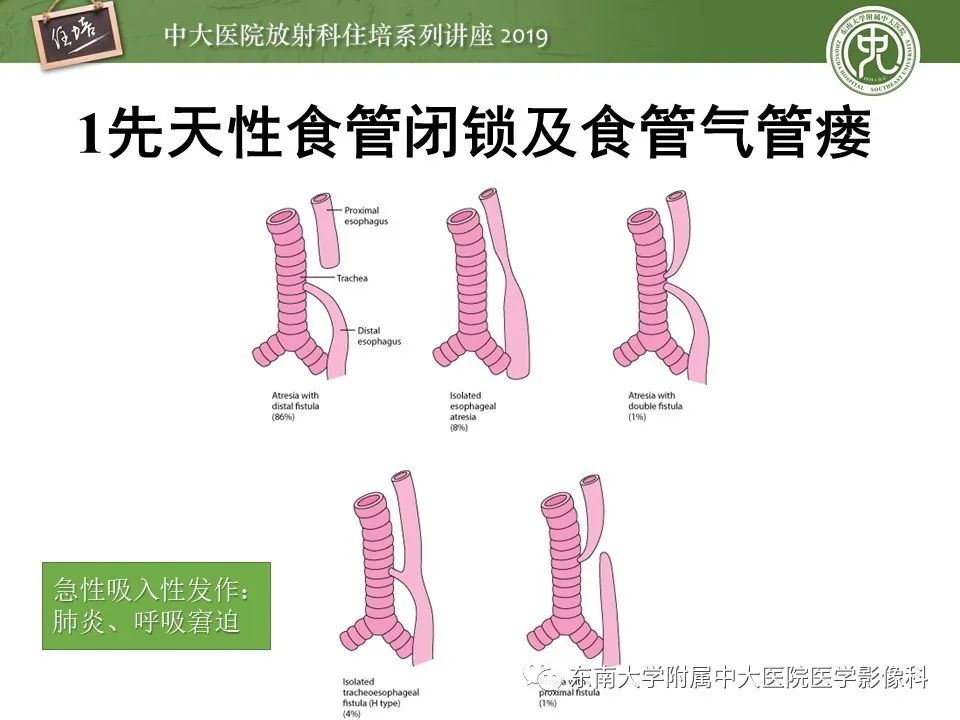 【PPT】呼吸系统急症影像解读