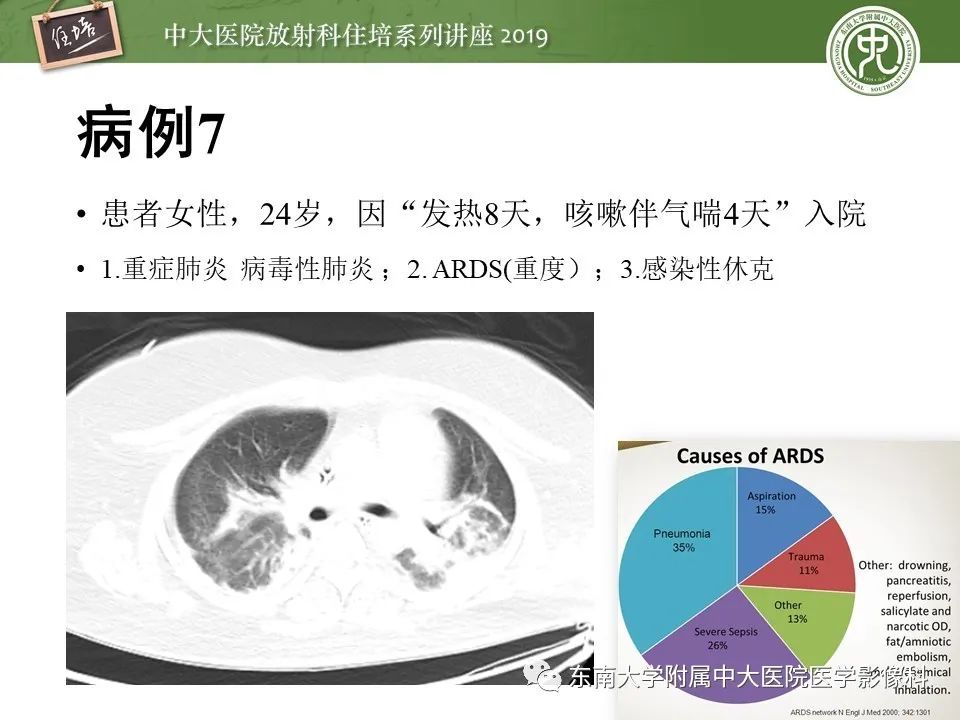 【PPT】呼吸系统急症影像解读