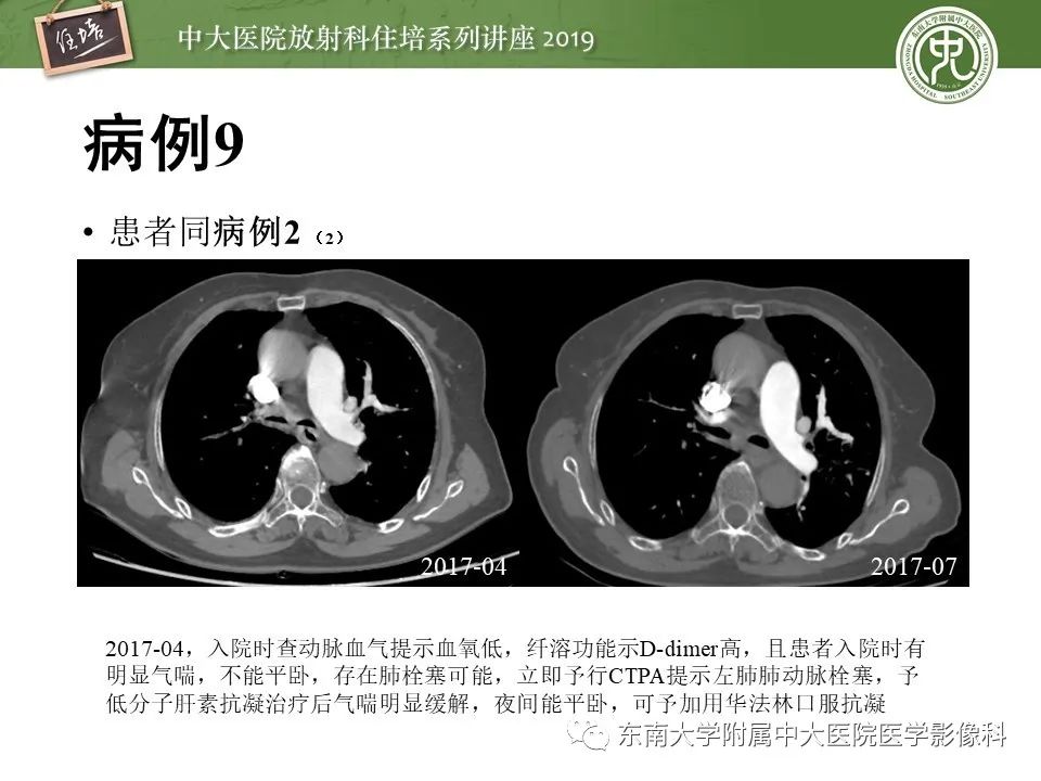 【PPT】呼吸系统急症影像解读