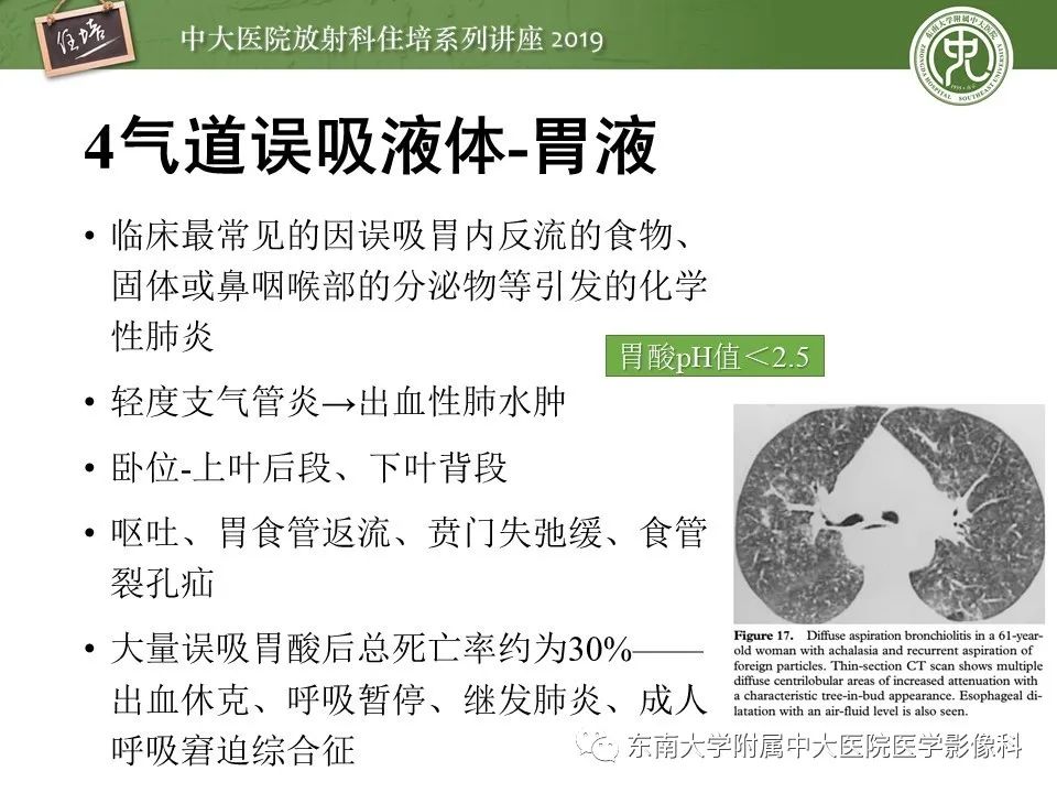 【PPT】呼吸系统急症影像解读