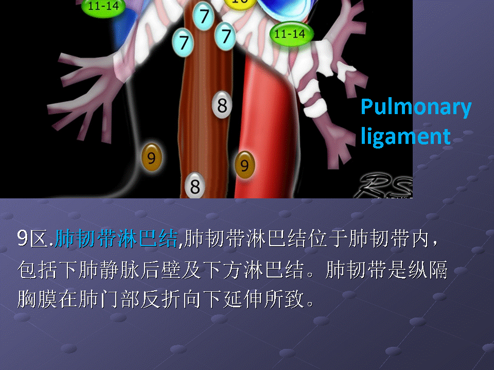 幻灯片72