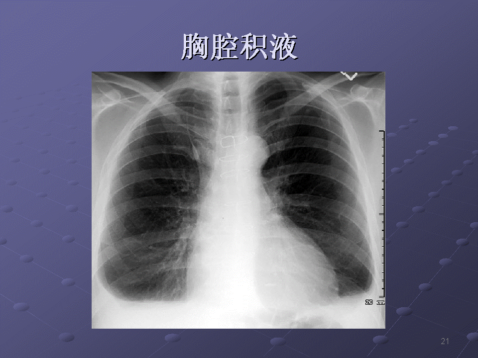 幻灯片21