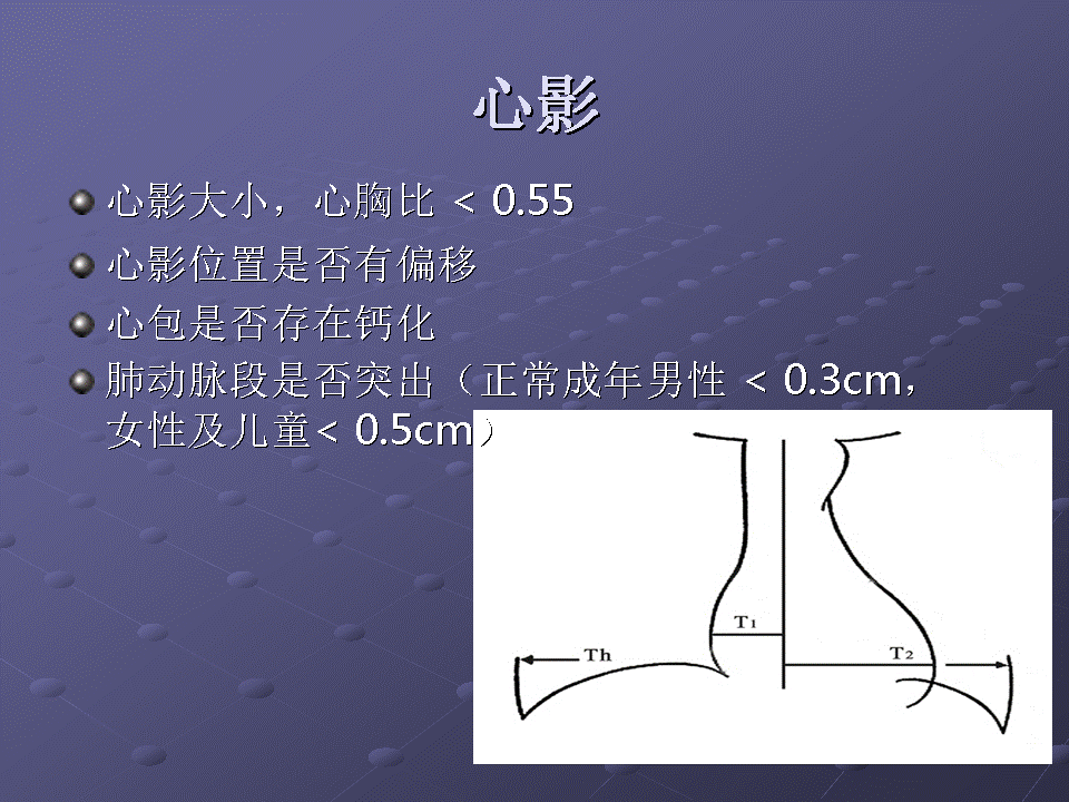 幻灯片18