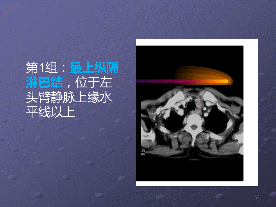 幻灯片62