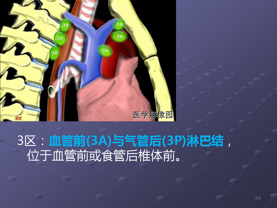 幻灯片64