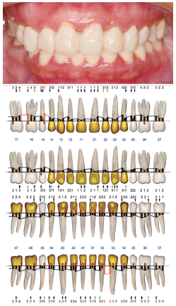 1583283087348849.png