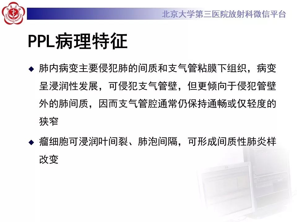 【病例】原发性肺淋巴瘤1例CT影像