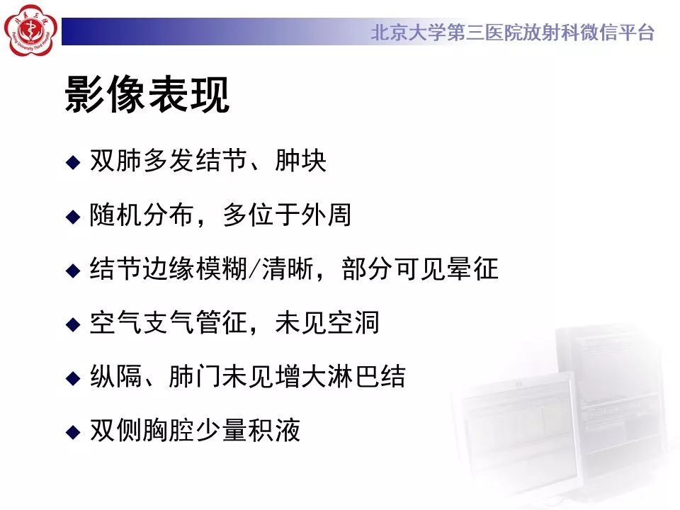 【病例】原发性肺淋巴瘤1例CT影像