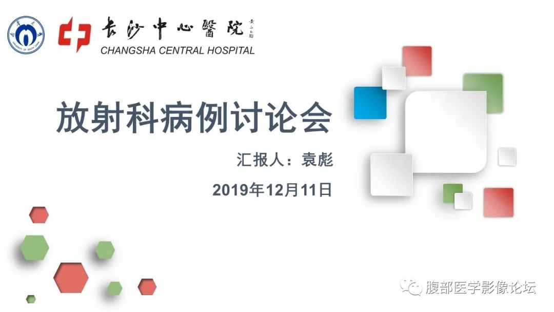 【病例】结肠脂肪瘤伴肠套叠1例CT