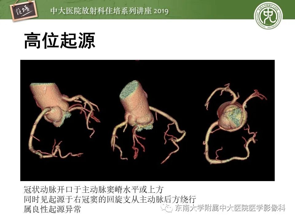 【PPT】冠状动脉CTA诊断流程