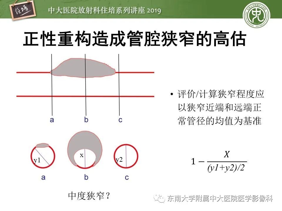 【PPT】冠状动脉CTA诊断流程