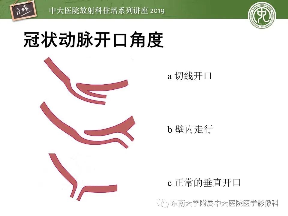 【PPT】冠状动脉CTA诊断流程