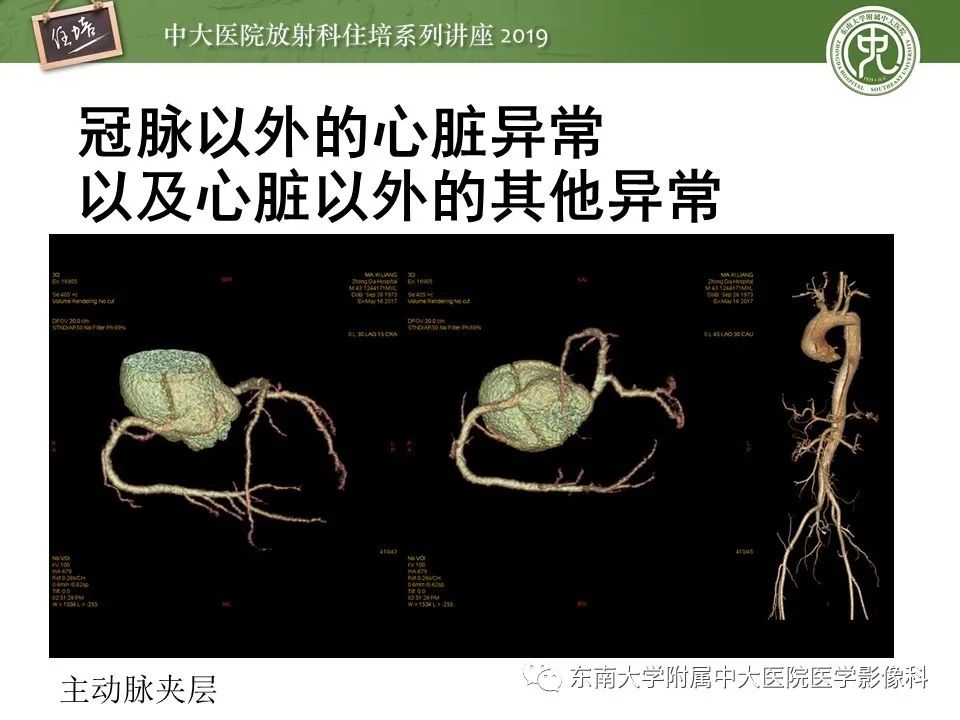 【PPT】冠状动脉CTA诊断流程